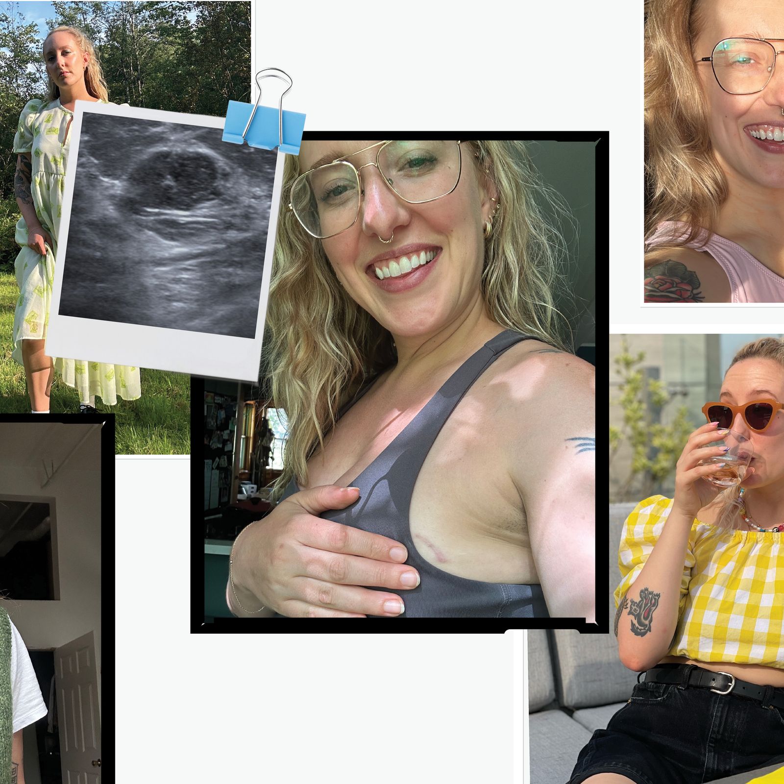My 10-Year Journey to Figuring Out My Chronic Breast Pain