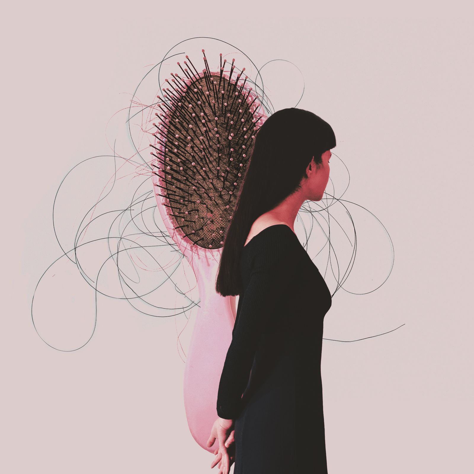 A New Form of Alopecia Is Affecting Menopausal Women